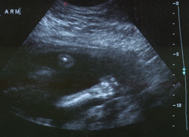 babyarm.jpg