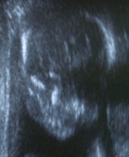 babyface1.jpg